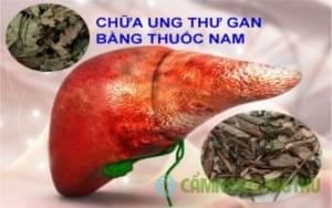 dieu tri ung thu gan bang thuoc nam